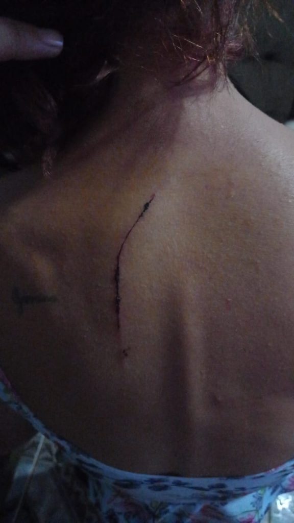 Mulher é agredida com golpe de facão