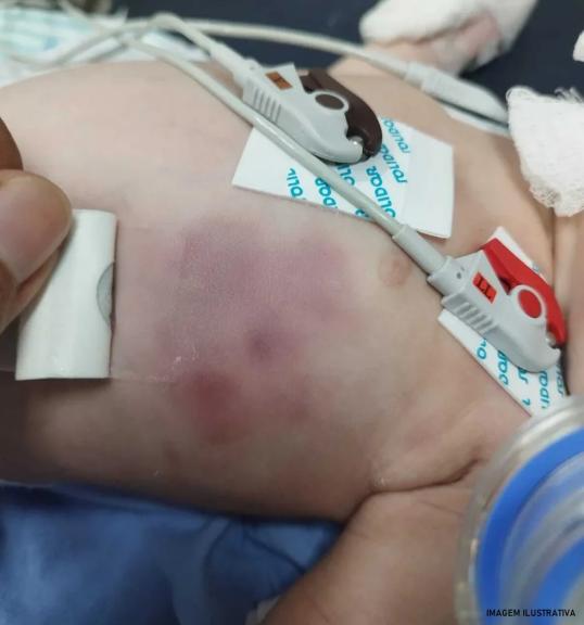 Jovem de 18 anos é preso suspeito de torturar a própria filha recém-nascida