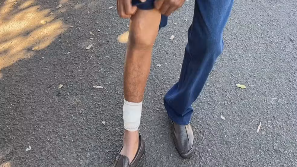 Idoso tem braço amputado e homem fica ferido após ataque de pitbull no interior de SP
