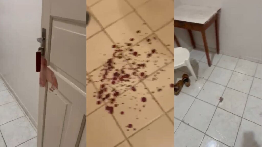 Sob efeito de drogas, homem agride funcionária de hotel e deixa vítima ferida em Dracena